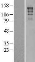 ERCC5 / XPG Protein - Western validation with an anti-DDK antibody * L: Control HEK293 lysate R: Over-expression lysate