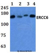 ERCC6 / CSB Antibody - Western blot of ERCC6 antibody at 1:500 dilution. Lane 1: HEK293T whole cell lysate. Lane 2: Raw264.7 whole cell lysate. Lane 3: H9C2 whole cell lysate. Lane 4: HELA whole cell ly.
