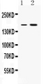 ERCC6 / CSB Antibody - Western blot - Anti-CSB Picoband Antibody