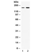 ERCC6 / CSB Antibody - Western blot testing of 1) rat liver and 2) COLO320 lysate with CSB antibody at 0.5ug/ml. Predicted/observed molecular weight: ~168 kDa.