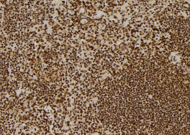 ERCC6 / CSB Antibody - 1:100 staining mouse spleen tissue by IHC-P. The sample was formaldehyde fixed and a heat mediated antigen retrieval step in citrate buffer was performed. The sample was then blocked and incubated with the antibody for 1.5 hours at 22°C. An HRP conjugated goat anti-rabbit antibody was used as the secondary.