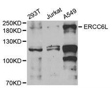 ERCC6L / FLJ20105 Antibody - Western blot analysis of extracts of various cell lines, using ERCC6L antibody.