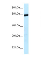ERCC6L2 Antibody - C9orf102 antibody Western blot of Mouse Liver lysate. Antibody concentration 1 ug/ml.  This image was taken for the unconjugated form of this product. Other forms have not been tested.