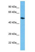 ERCC6L2 Antibody - ERCC6L2 antibody Western Blot of Breast Tumor. Antibody dilution: 1 ug/ml.  This image was taken for the unconjugated form of this product. Other forms have not been tested.