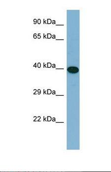 ERCC6L2 Antibody - Western blot of Human HT1080. ERCC6L2 antibody dilution 1.0 ug/ml.  This image was taken for the unconjugated form of this product. Other forms have not been tested.