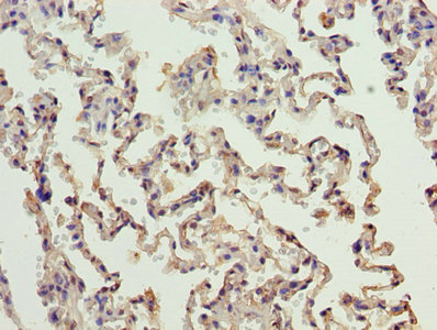 ERCC6L2 Antibody - Immunohistochemistry of paraffin-embedded human lung tissue using ERCC6L2 Antibody at dilution of 1:100