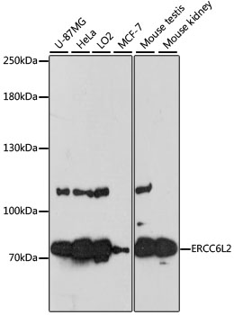 ERCC6L2 Antibody - Western blot analysis of extracts of various cell lines, using ERCC6L2 antibody at 1:3000 dilution. The secondary antibody used was an HRP Goat Anti-Rabbit IgG (H+L) at 1:10000 dilution. Lysates were loaded 25ug per lane and 3% nonfat dry milk in TBST was used for blocking. An ECL Kit was used for detection and the exposure time was 60s.