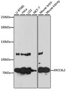ERCC6L2 Antibody - Western blot analysis of extracts of various cell lines, using ERCC6L2 antibody at 1:3000 dilution. The secondary antibody used was an HRP Goat Anti-Rabbit IgG (H+L) at 1:10000 dilution. Lysates were loaded 25ug per lane and 3% nonfat dry milk in TBST was used for blocking. An ECL Kit was used for detection and the exposure time was 60s.