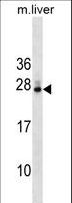 ERdj4 / DNAJB9 Antibody - DNAJB9 Antibody western blot of mouse liver tissue lysates (35 ug/lane). The DNAJB9 antibody detected the DNAJB9 protein (arrow).