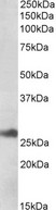 ERdj4 / DNAJB9 Antibody - ERdj4 / DNAJB9 antibody (1µg/ml) staining of Human Liver lysate (35µg protein in RIPA buffer). Detected by chemiluminescence.