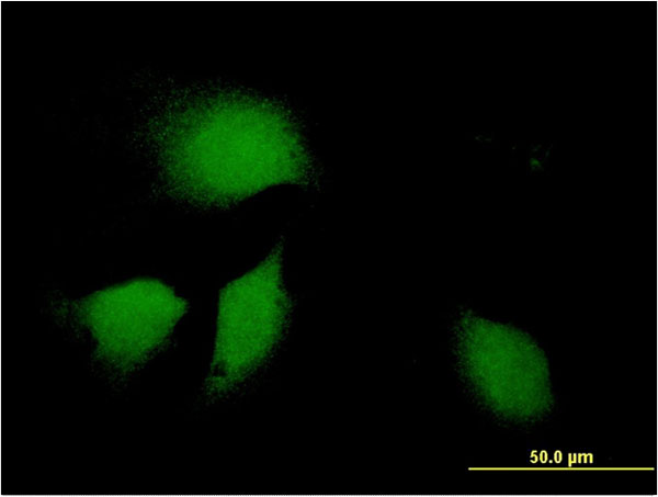 ERdj4 / DNAJB9 Antibody - Immunofluorescence of monoclonal antibody to DNAJB9 on HeLa cell . [antibody concentration 10 ug/ml]