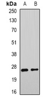 ERdj4 / DNAJB9 Antibody - Western blot analysis of DNAJB9 expression in mouse liver (A); rat liver (B) whole cell lysates.