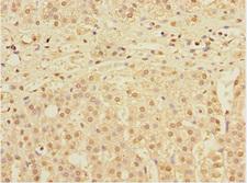 ERdj4 / DNAJB9 Antibody - Immunohistochemistry of paraffin-embedded human adrenal gland tissue at dilution 1:100