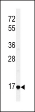 EREG / Epiregulin Antibody - Western blot of EREG Antibody in HepG2 cell line lysates (35 ug/lane). EREG (arrow) was detected using the purified antibody.