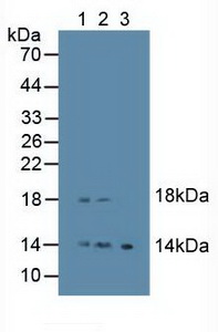 EREG / Epiregulin Antibody - Western Blot; Sample: Lane1: Human Placenta Tissue; Lane2: Human Lymphocytes Cells; Lane3: Mouse Lymphocytes Cells.