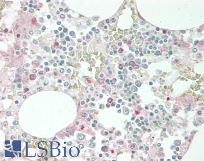 EREG / Epiregulin Antibody - Human Bone Marrow: Formalin-Fixed, Paraffin-Embedded (FFPE).  This image was taken for the unconjugated form of this product. Other forms have not been tested.