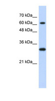 ERF / PE2 Antibody - ERF / PE-2 antibody Western blot of Transfected 293T cell lysate. This image was taken for the unconjugated form of this product. Other forms have not been tested.
