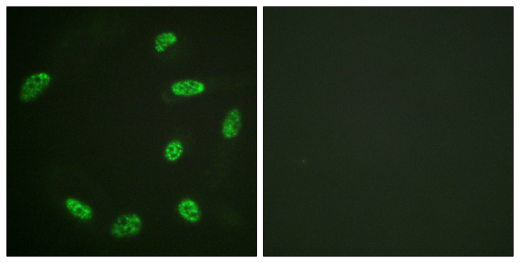 ERF / PE2 Antibody - Immunofluorescence analysis of HeLa cells, using ERF Antibody. The picture on the right is blocked with the synthesized peptide.