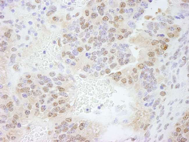 ERF / PE2 Antibody - Detection of Mouse ERF by Immunohistochemistry. Sample: FFPE section of mouse teratoma. Antibody: Affinity purified rabbit anti-ERF used at a dilution of 1:500.