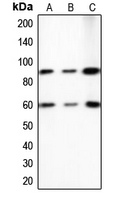 ERF / PE2 Antibody - Western blot analysis of PE2 expression in A431 (A); HeLa (B); NIH3T3 (C) whole cell lysates.