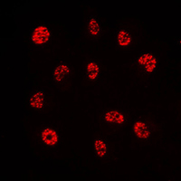 ERF / PE2 Antibody - Immunofluorescent analysis of PE2 staining in HeLa cells. Formalin-fixed cells were permeabilized with 0.1% Triton X-100 in TBS for 5-10 minutes and blocked with 3% BSA-PBS for 30 minutes at room temperature. Cells were probed with the primary antibody in 3% BSA-PBS and incubated overnight at 4 C in a humidified chamber. Cells were washed with PBST and incubated with a DyLight 594-conjugated secondary antibody (red) in PBS at room temperature in the dark. DAPI was used to stain the cell nuclei (blue).