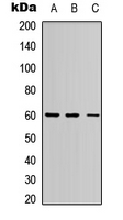 ERF / PE2 Antibody - Western blot analysis of PE2 expression in HEK293T (A); Raw264.7 (B); PC12 (C) whole cell lysates.