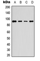 ERF / PE2 Antibody - Western blot analysis of PE2 (pT526) expression in HEK293 (A); MCF7 (B); mouse lung (C); rat lung (D) whole cell lysates.
