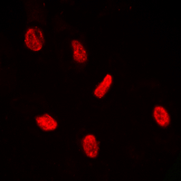 ERF / PE2 Antibody - Immunofluorescent analysis of PE2 (pT526) staining in HeLa cells. Formalin-fixed cells were permeabilized with 0.1% Triton X-100 in TBS for 5-10 minutes and blocked with 3% BSA-PBS for 30 minutes at room temperature. Cells were probed with the primary antibody in 3% BSA-PBS and incubated overnight at 4 deg C in a humidified chamber. Cells were washed with PBST and incubated with a DyLight 594-conjugated secondary antibody (red) in PBS at room temperature in the dark. DAPI was used to stain the cell nuclei (blue).