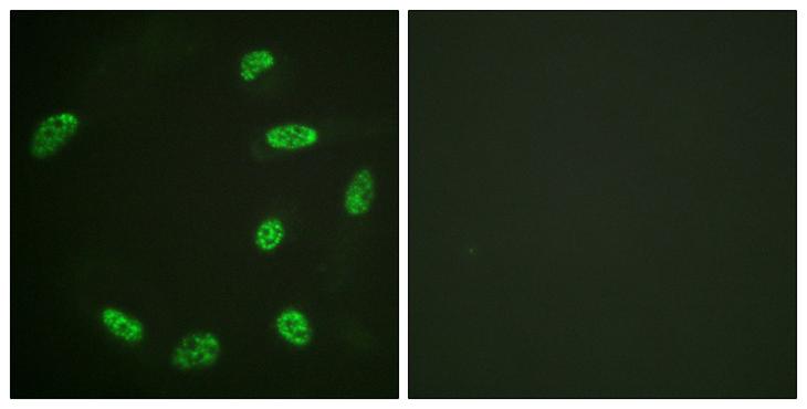 ERF / PE2 Antibody - Peptide - + Immunofluorescence analysis of HeLa cells, using ERF antibody.