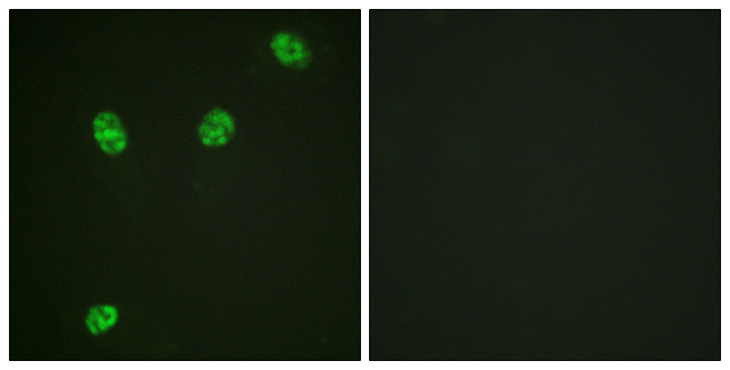 ERF / PE2 Antibody - Immunofluorescence analysis of HeLa cells, using ERF (Phospho-Thr526) Antibody. The picture on the right is blocked with the phospho peptide.