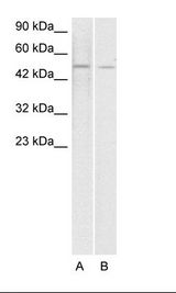 ERG Antibody - A. Jurkat Cell Lysate B. HepG2 Cell Lysate.  This image was taken for the unconjugated form of this product. Other forms have not been tested.
