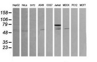 ERG Antibody - Western blot of extracts (35 ug) from 9 different cell lines by using anti-ERG monoclonal antibody (HepG2: human; HeLa: human; SVT2: mouse; A549: human; COS7: monkey; Jurkat: human; MDCK: canine; PC12: rat; MCF7: human).