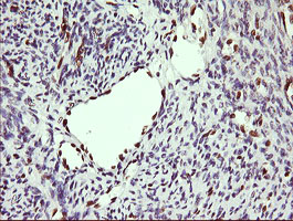 ERG Antibody - IHC of paraffin-embedded Human endometrium tissue using anti-ERG mouse monoclonal antibody.