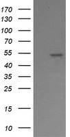 ERG Antibody - HEK293T cells were transfected with the pCMV6-ENTRY control (Left lane) or pCMV6-ENTRY ERG (Right lane) cDNA for 48 hrs and lysed. Equivalent amounts of cell lysates (5 ug per lane) were separated by SDS-PAGE and immunoblotted with anti-ERG.