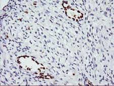 ERG Antibody - IHC of paraffin-embedded Human Ovary tissue using anti-ERG mouse monoclonal antibody.