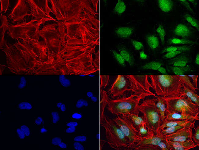 ERG Antibody - Immunofluorescent staining of HeLa cells using anti-ERG mouse monoclonal antibody  green, 1:50). Actin filaments were labeled with Alexa Fluor® 594 Phalloidin. (red), and nuclear with DAPI. (blue).