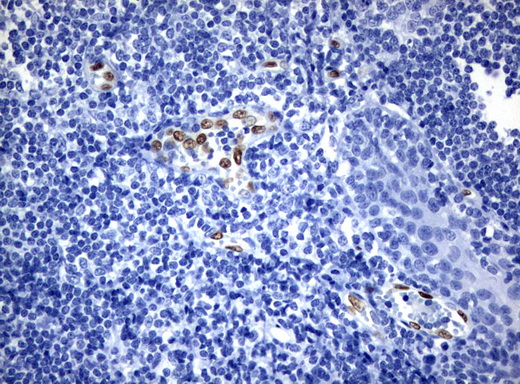 ERG Antibody - Immunohistochemical staining of paraffin-embedded Human tonsil using anti-ERG mouse monoclonal antibody.  heat-induced epitope retrieval by 10mM citric buffer, pH6.0, 120C for 3min)