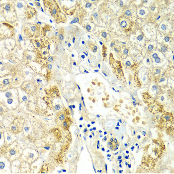 ERG Antibody - Immunohistochemistry of paraffin-embedded Human liver injury tissue.
