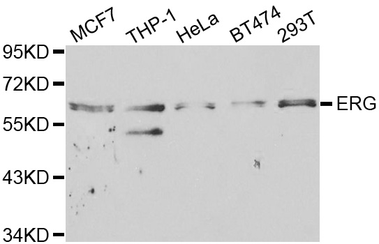 ERG Antibody - Western blot analysis of extracts of various cell lines, using ERG antibody at 1:1000 dilution. The secondary antibody used was an HRP Goat Anti-Rabbit IgG (H+L) at 1:10000 dilution. Lysates were loaded 25ug per lane and 3% nonfat dry milk in TBST was used for blocking.