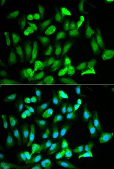 ERG Antibody - Immunofluorescence analysis of HeLa cells using ERG antibody. Blue: DAPI for nuclear staining.
