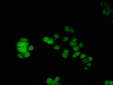 ERG Antibody - Immunofluorescent analysis of PC-3 cells using ERG Antibody at dilution of 1:100 and Alexa Fluor 488-congugated AffiniPure Goat Anti-Rabbit IgG(H+L)