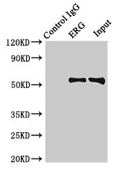 ERG Antibody - Immunoprecipitating ERG in Rat heart tissue Lane 1: Rabbit control IgG (1µg) instead of ERG Antibody in Rat heart tissue.For western blotting, a HRP-conjugated Protein G antibody was used as the secondary antibody (1/2000) Lane 2: ERG Antibody (8µg) + Rat heart tissue (500µg) Lane 3: Rat heart tissue (10µg)