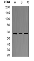 ERG Antibody - Western blot analysis of ERG expression in MCF7 (A); THP1 (B); HeLa (C) whole cell lysates.