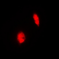 ERG Antibody - Immunofluorescent analysis of ERG staining in HeLa cells. Formalin-fixed cells were permeabilized with 0.1% Triton X-100 in TBS for 5-10 minutes and blocked with 3% BSA-PBS for 30 minutes at room temperature. Cells were probed with the primary antibody in 3% BSA-PBS and incubated overnight at 4 deg C in a humidified chamber. Cells were washed with PBST and incubated with a DyLight 594-conjugated secondary antibody (red) in PBS at room temperature in the dark.