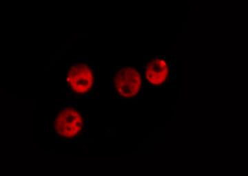 ERG Antibody - Staining HeLa cells by IF/ICC. The samples were fixed with PFA and permeabilized in 0.1% Triton X-100, then blocked in 10% serum for 45 min at 25°C. The primary antibody was diluted at 1:200 and incubated with the sample for 1 hour at 37°C. An Alexa Fluor 594 conjugated goat anti-rabbit IgG (H+L) antibody, diluted at 1/600 was used as secondary antibody.