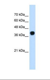 ERG1 / SQLE Antibody - 721_B cell lysate. Antibody concentration: 0.25 ug/ml. Gel concentration: 12%.  This image was taken for the unconjugated form of this product. Other forms have not been tested.
