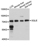 ERG1 / SQLE Antibody - Western blot analysis of extracts of various cells.