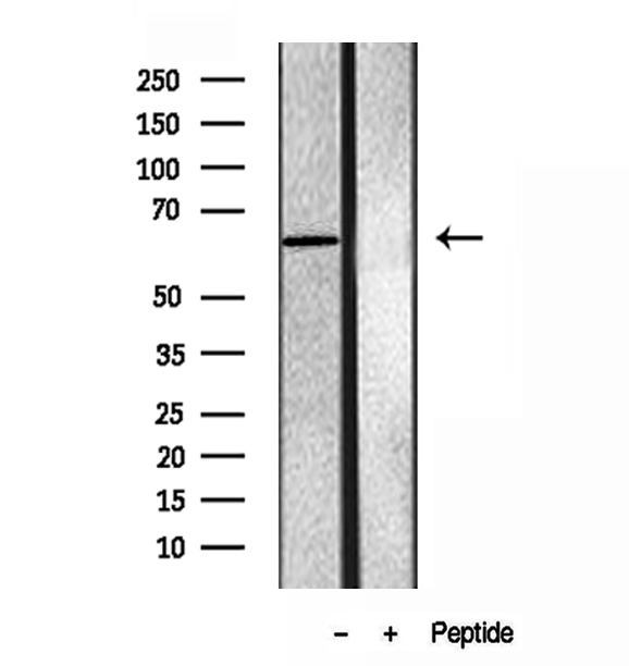 ERG1 / SQLE Antibody - Western blot analysis of extracts of A549 cells using SQLE antibody.