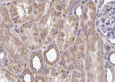 ERG1 / SQLE Antibody - 1:100 staining mouse kidney tissue by IHC-P. The sample was formaldehyde fixed and a heat mediated antigen retrieval step in citrate buffer was performed. The sample was then blocked and incubated with the antibody for 1.5 hours at 22°C. An HRP conjugated goat anti-rabbit antibody was used as the secondary.