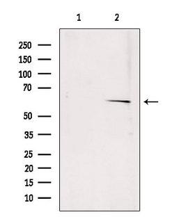 ERG1 / SQLE Antibody - Western blot analysis of extracts of rat muscle using SQLE antibody. Lane 1 was treated with the blocking peptide.